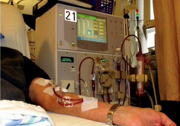 patient receiving dialysis